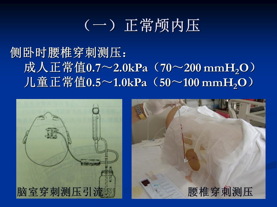 唐贝颅内压增高病人的护理精选文档.ppt_第2页