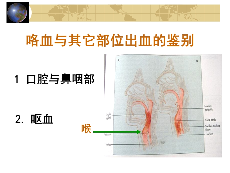 最新：检体诊断学咯血1文档资料.ppt_第3页