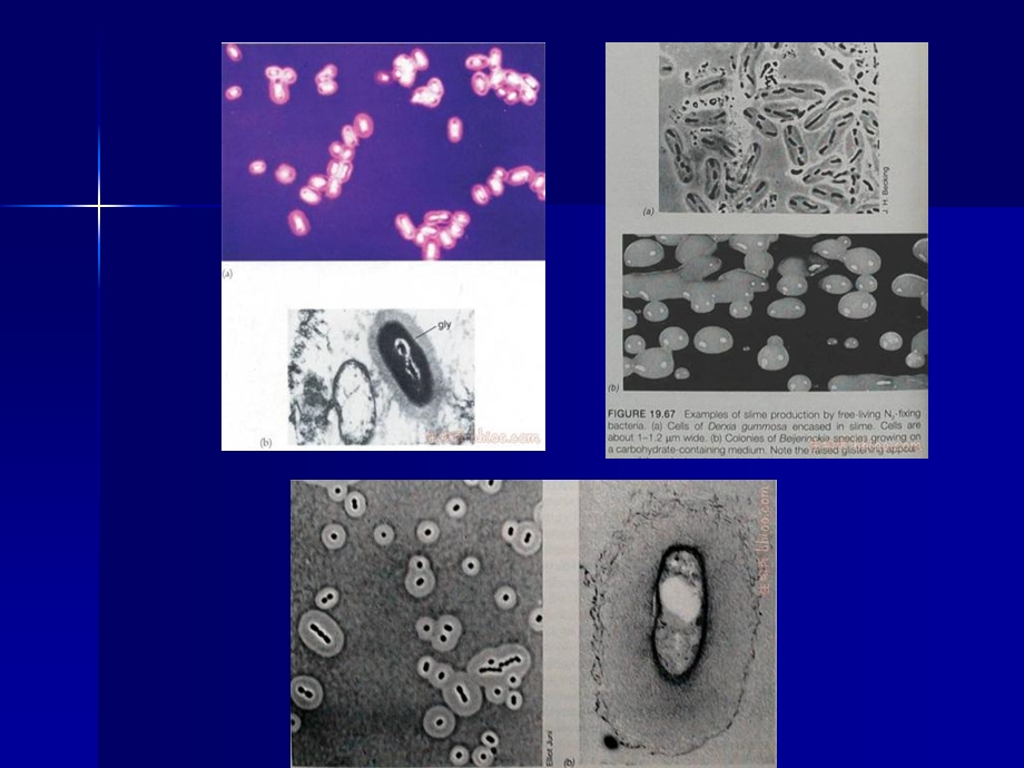 最新泰山医学院医学微生物学细菌的特殊结构PPT文档.ppt_第1页