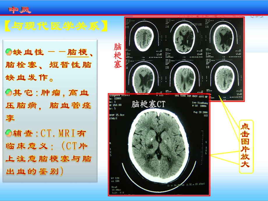 最新针灸治风课件PPT文档.ppt_第3页