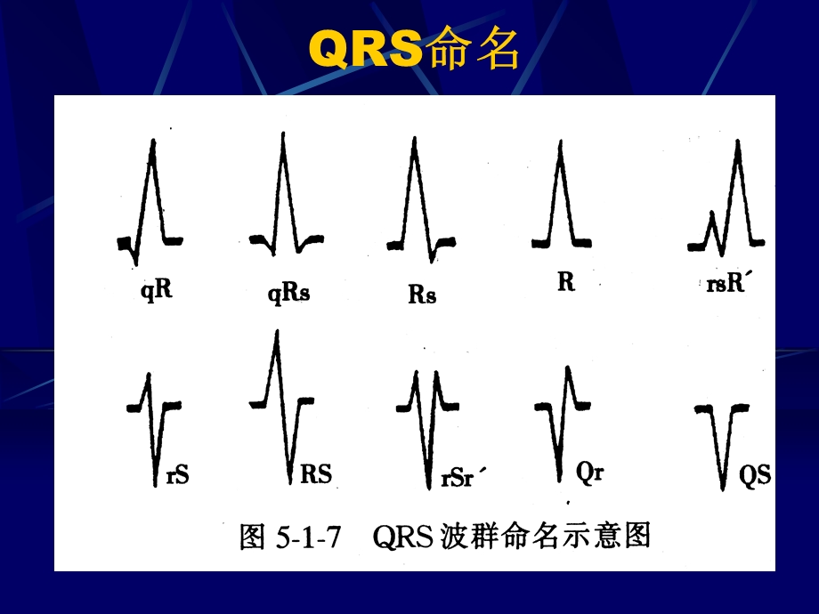 最新心电一院心电心肌缺血心梗心律失常PPT文档.ppt_第1页