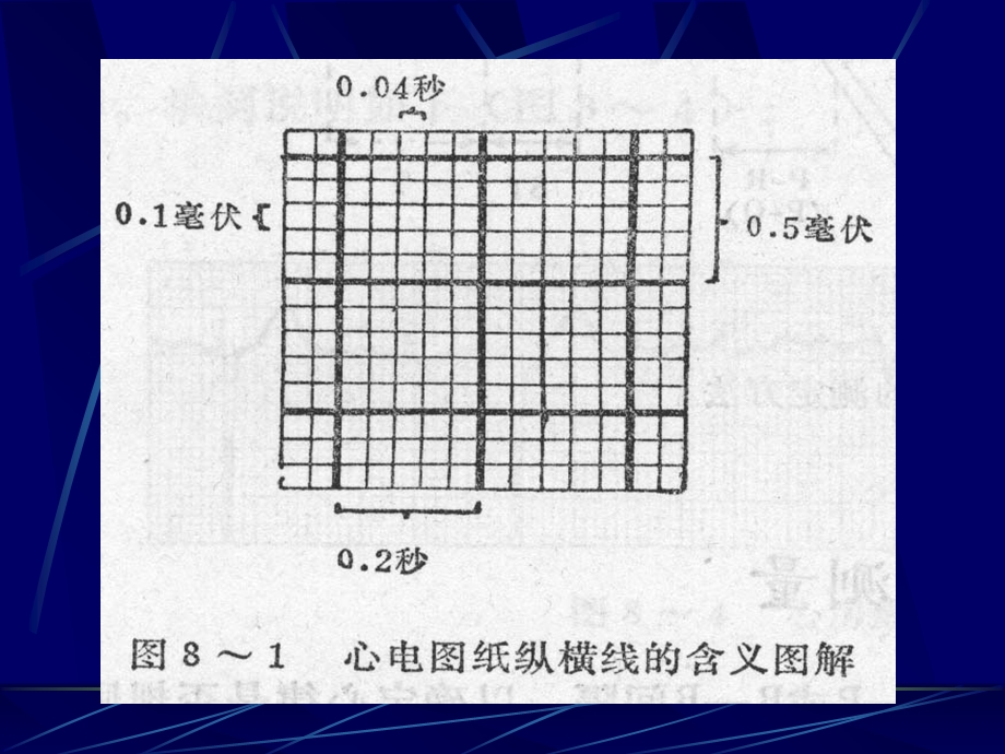 最新心电一院心电心肌缺血心梗心律失常PPT文档.ppt_第2页