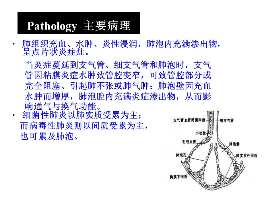 呼吸系统疾病2：支气管肺炎PPT课件.ppt_第3页