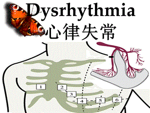最新内科护理学课件 英语 考试资料dysrhythmias..ppt