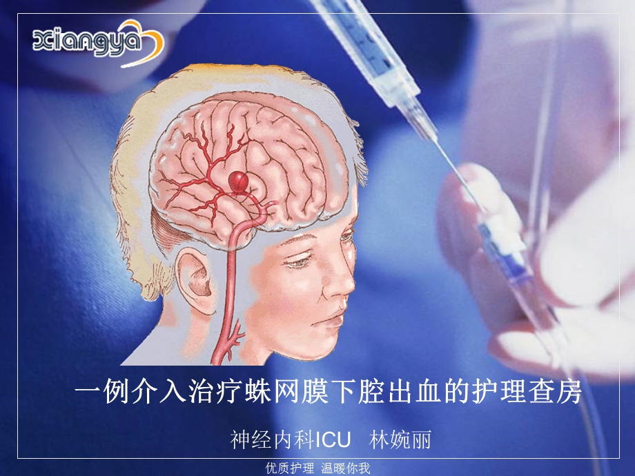 一例介入治疗蛛网膜下腔出血的护理查房定稿ppt课件.ppt_第1页