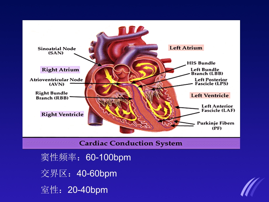 临床常见异常心电图的判读.ppt_第3页