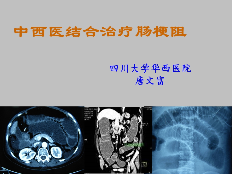 中西医结合治疗肠梗阻及循证证据.ppt_第1页