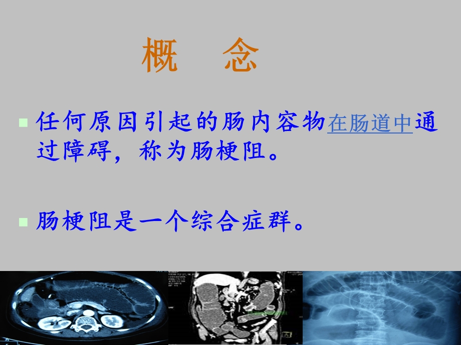 中西医结合治疗肠梗阻及循证证据.ppt_第2页