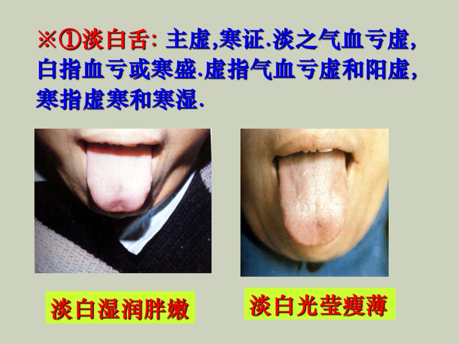 中医诊断学-舌诊图谱.ppt_第3页