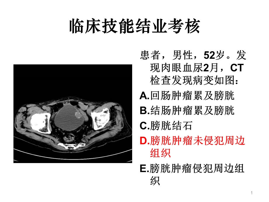 住院医师规陪出科考试辅助检查.ppt_第1页