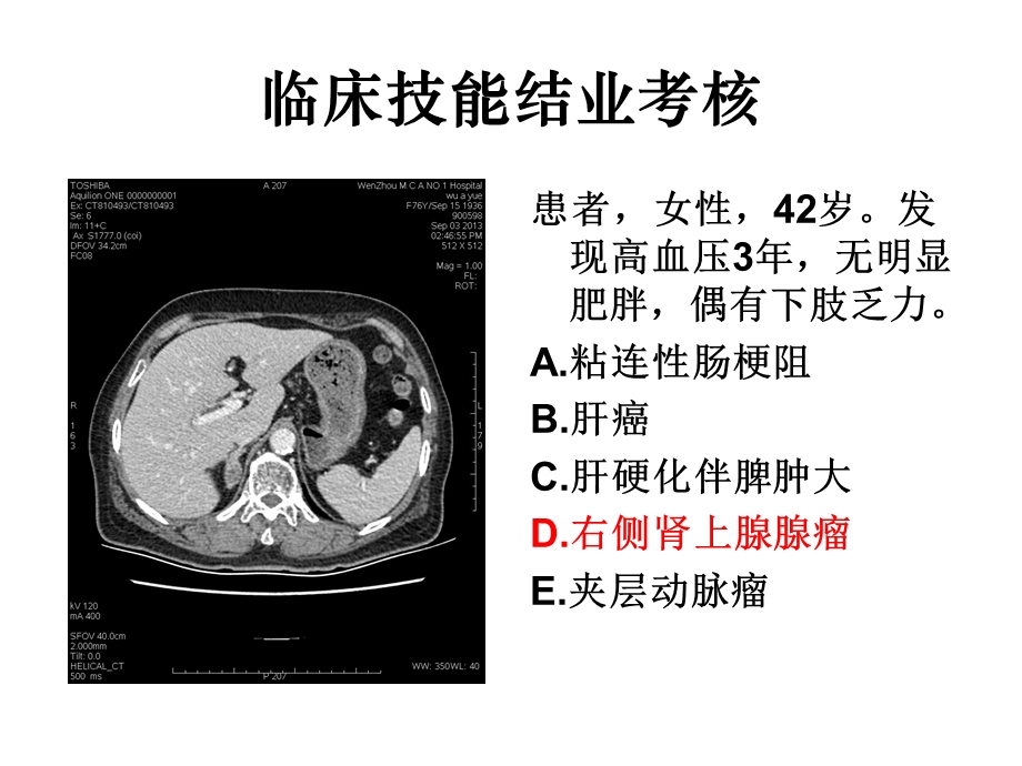 住院医师规陪出科考试辅助检查.ppt_第3页