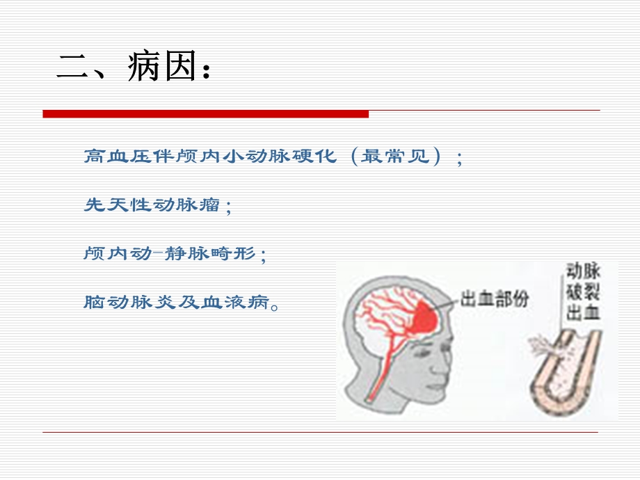 脑出血业务学习.ppt_第3页