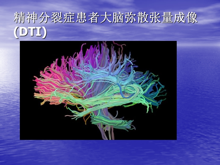 医学成像技术透视奇妙人体构造.ppt_第2页