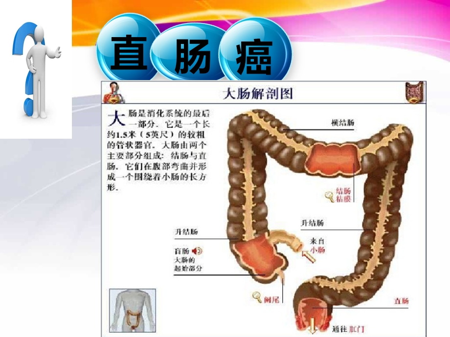 直肠癌的护理查房PPT.ppt_第3页