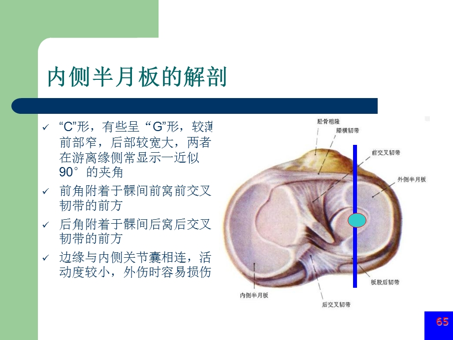 膝关节半月板损伤MRI诊断(ppt).ppt_第2页
