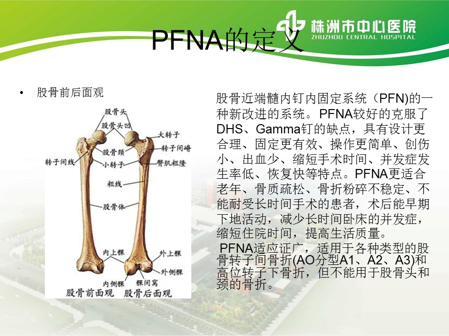 PFNA内固定术的护理查房.ppt_第2页