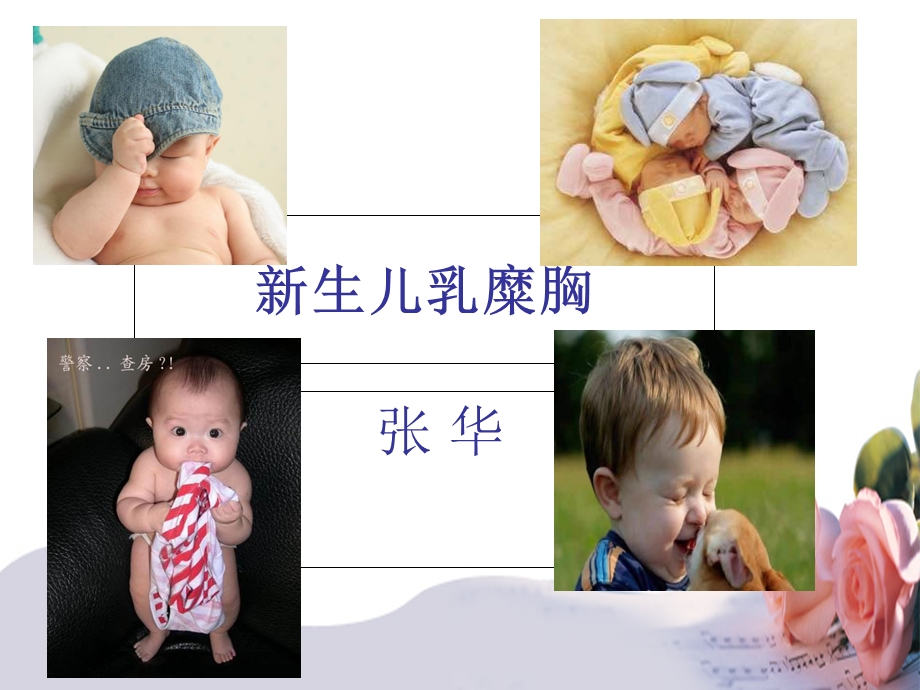 《乳糜胸查房》PPT课件.ppt_第1页