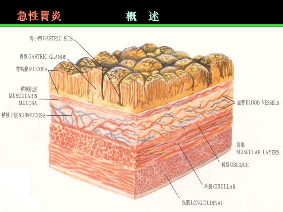 《急性胃炎》PPT课件.ppt_第3页