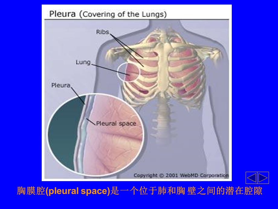 《胸腔积液解析》PPT课件.ppt_第3页