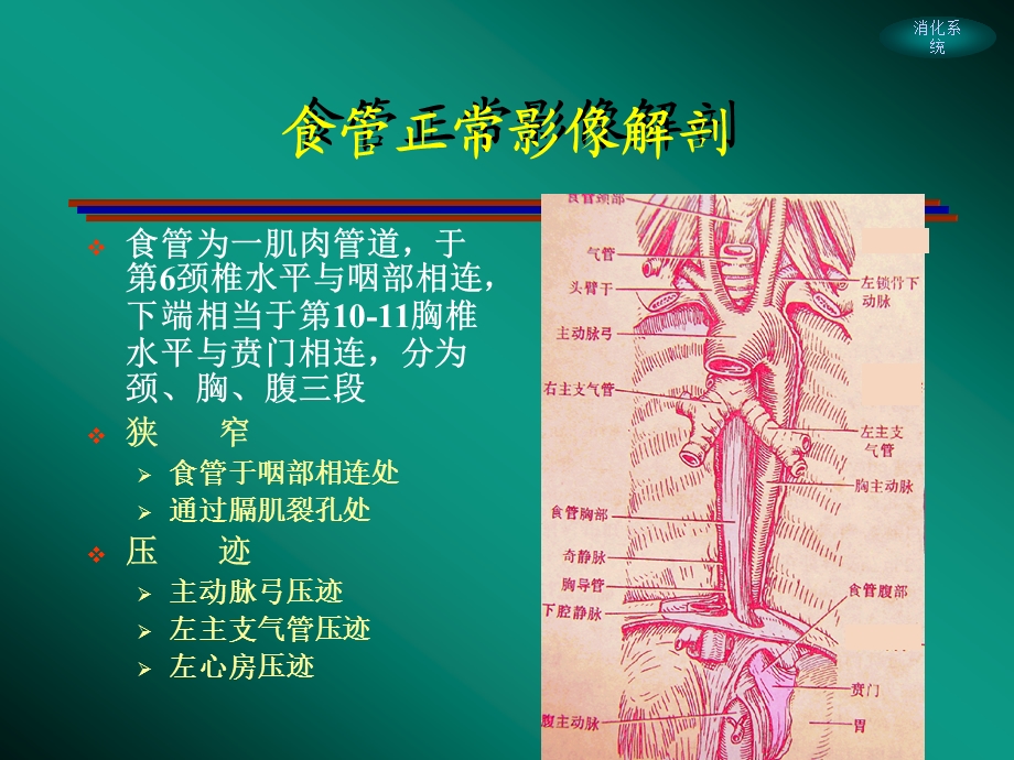 消化系统影像学.ppt_第3页