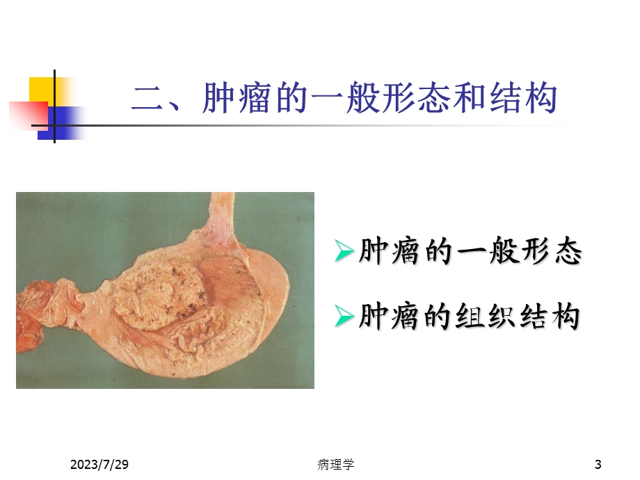 《肿瘤总论大纲》PPT课件.ppt_第3页