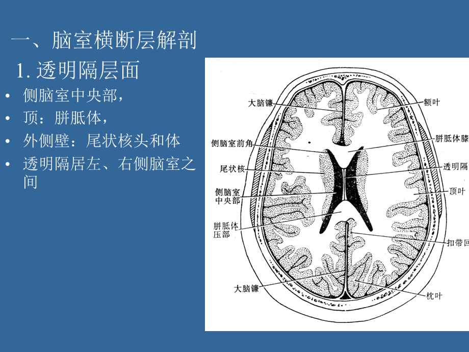 《脑室断层解剖》PPT课件.ppt_第3页