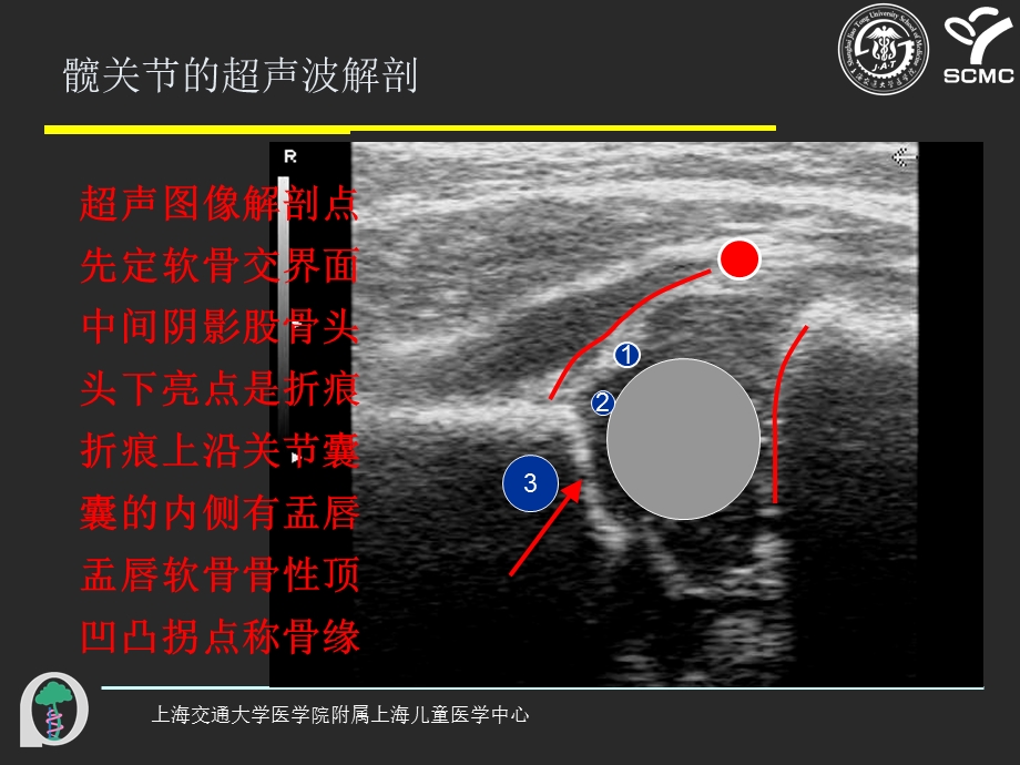 髋关节超声波检查的操作.ppt_第2页