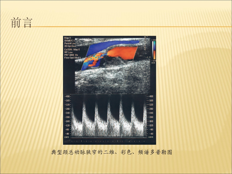 《血管超声基础》PPT课件.ppt_第2页