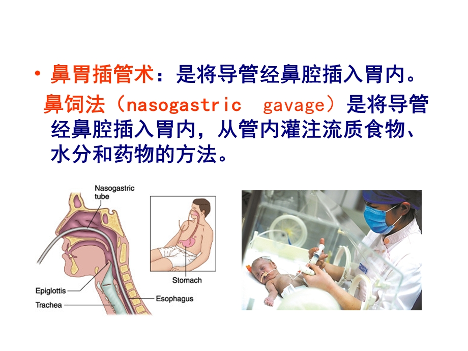 《小儿胃管置入术》PPT课件.ppt_第2页