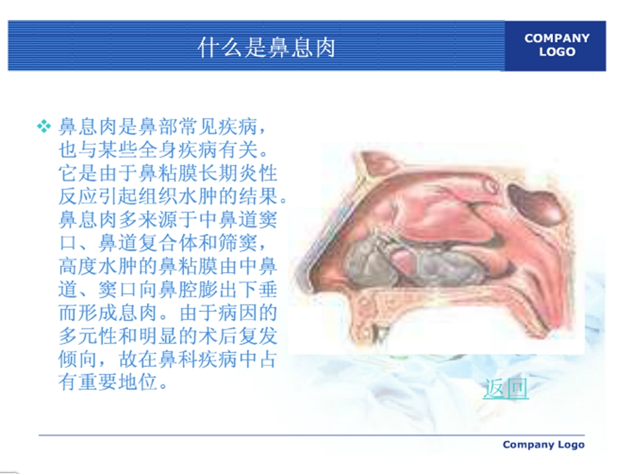 《鼻息肉护理》PPT课件.ppt_第2页