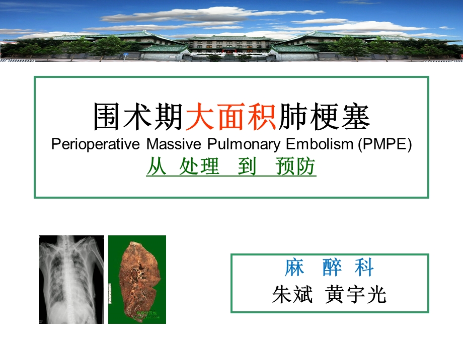 麻醉科围术期大面积肺梗塞for各科主任at医务处.ppt_第1页