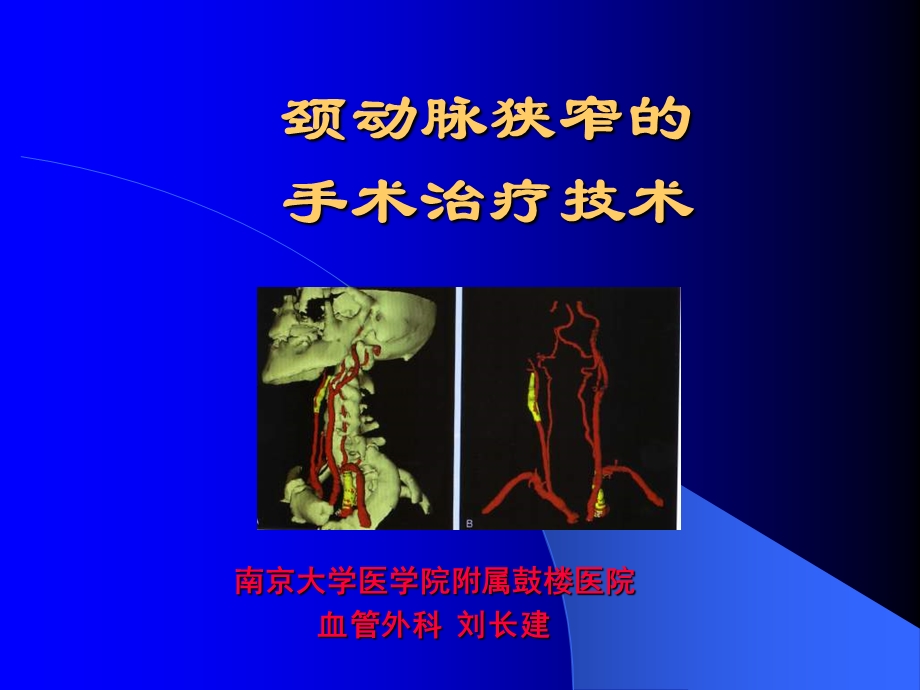 课件颈动脉狭窄的手术治疗技术.ppt_第1页