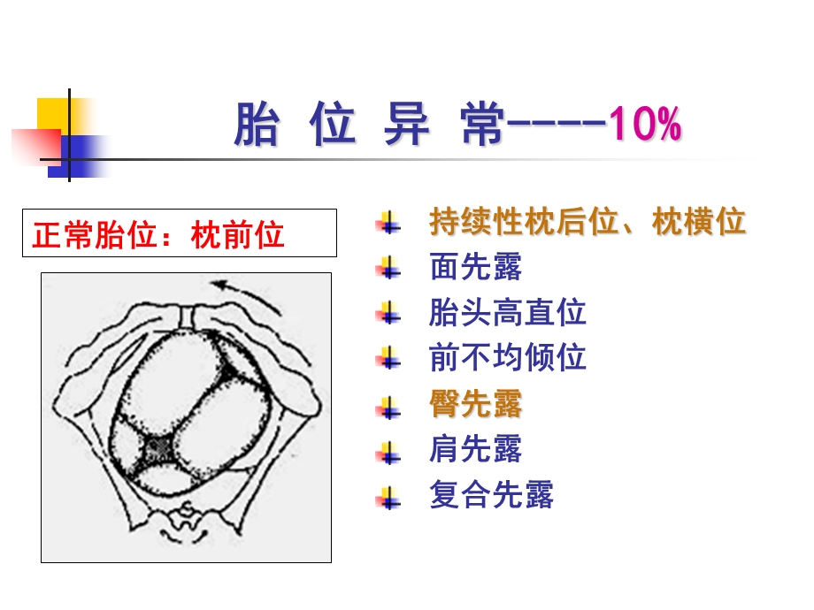 《胎位异常》PPT课件.ppt_第2页