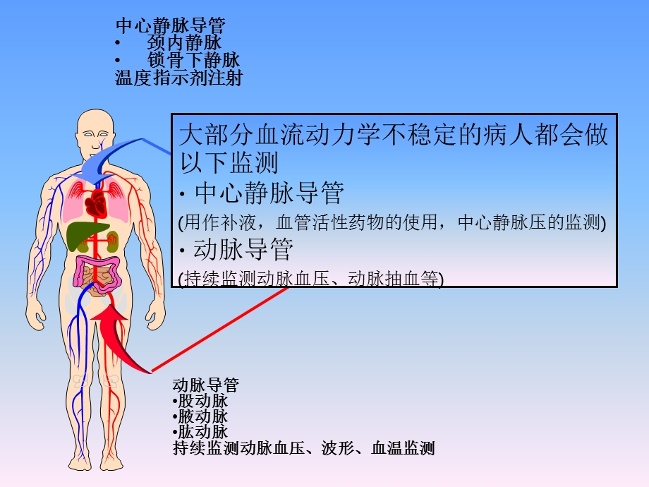 picco的监测与护理 ppt课件.ppt_第3页