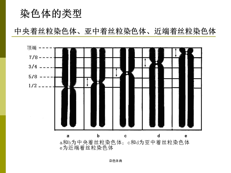 医学遗传学-染色体病ppt课件.ppt_第2页