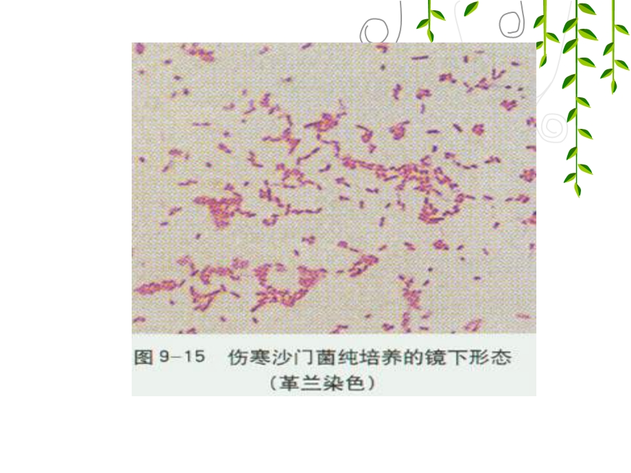 第四节伤寒病人的护理 ppt课件.ppt_第3页