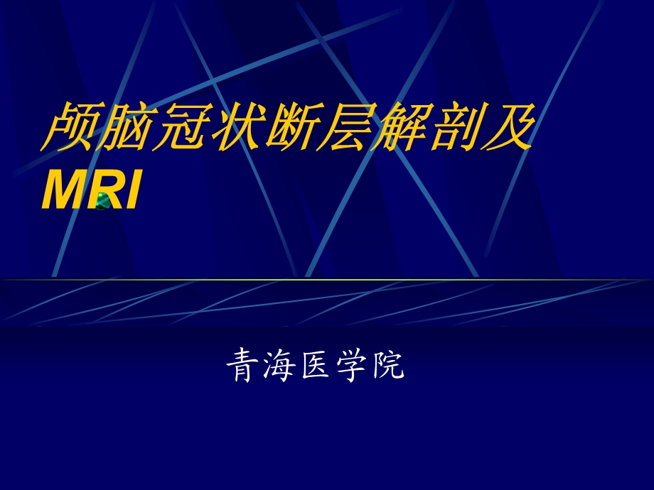 脑的冠状断面.ppt_第1页