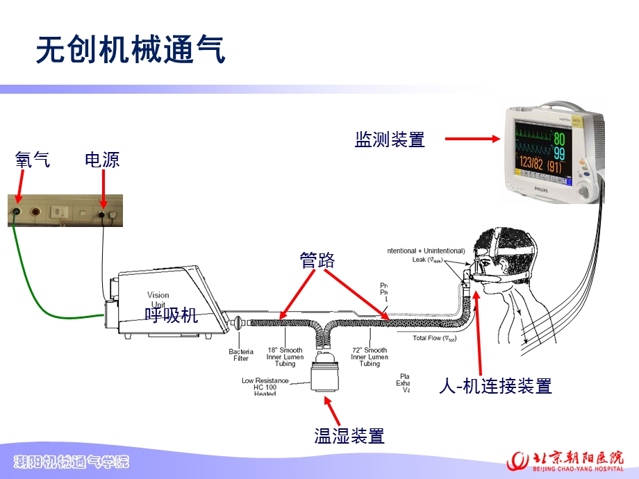 无创呼吸机-杨磊.ppt_第3页