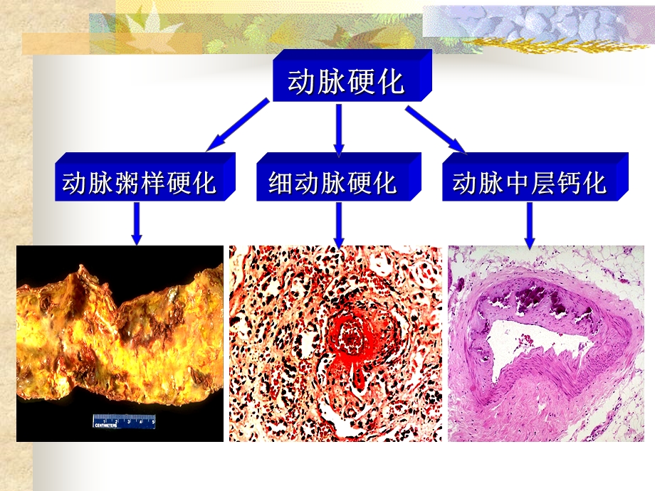 心血管研究生-jian.ppt_第3页