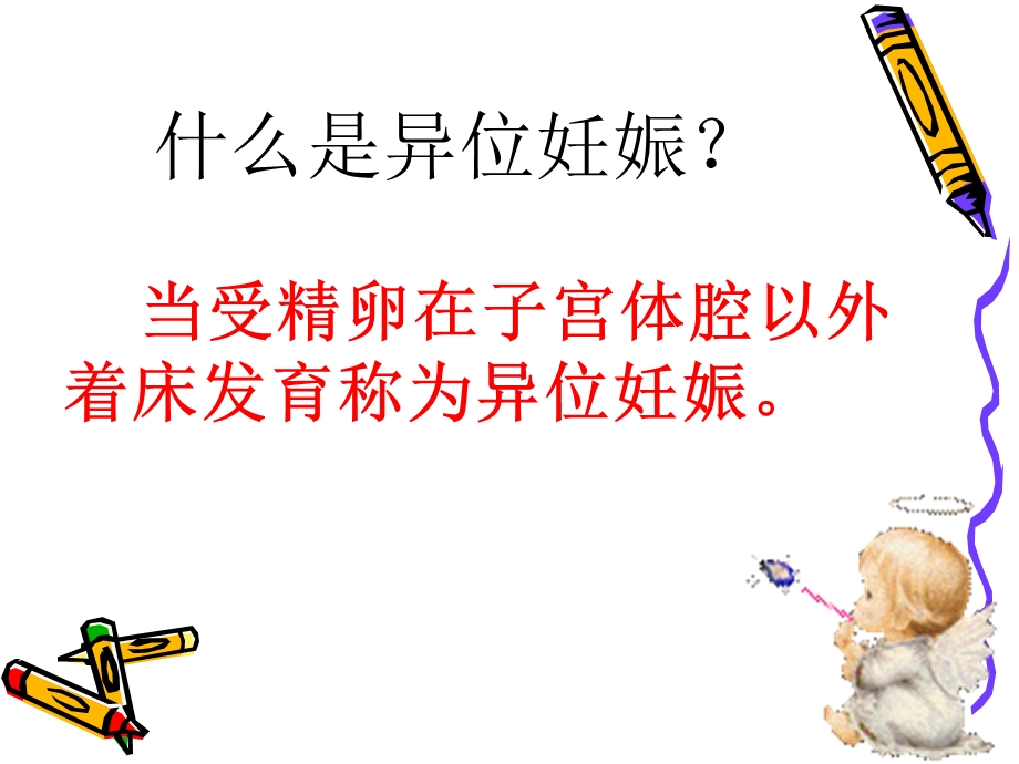 异位妊娠健教.ppt_第2页