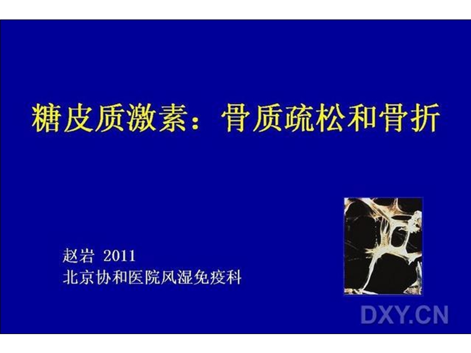 糖皮质激素骨质疏松和骨折.ppt_第2页