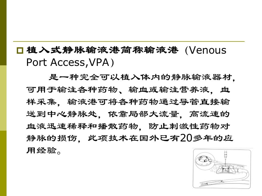 植入式静脉输液.ppt_第3页