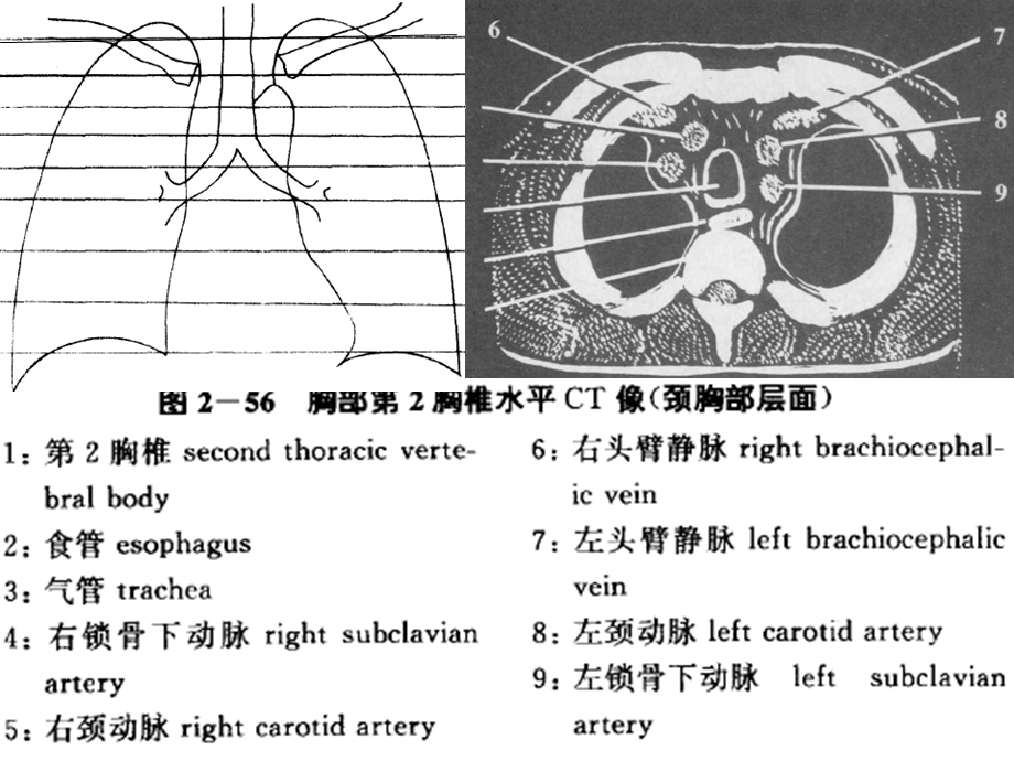 心血管系统CT读片手册.ppt_第2页