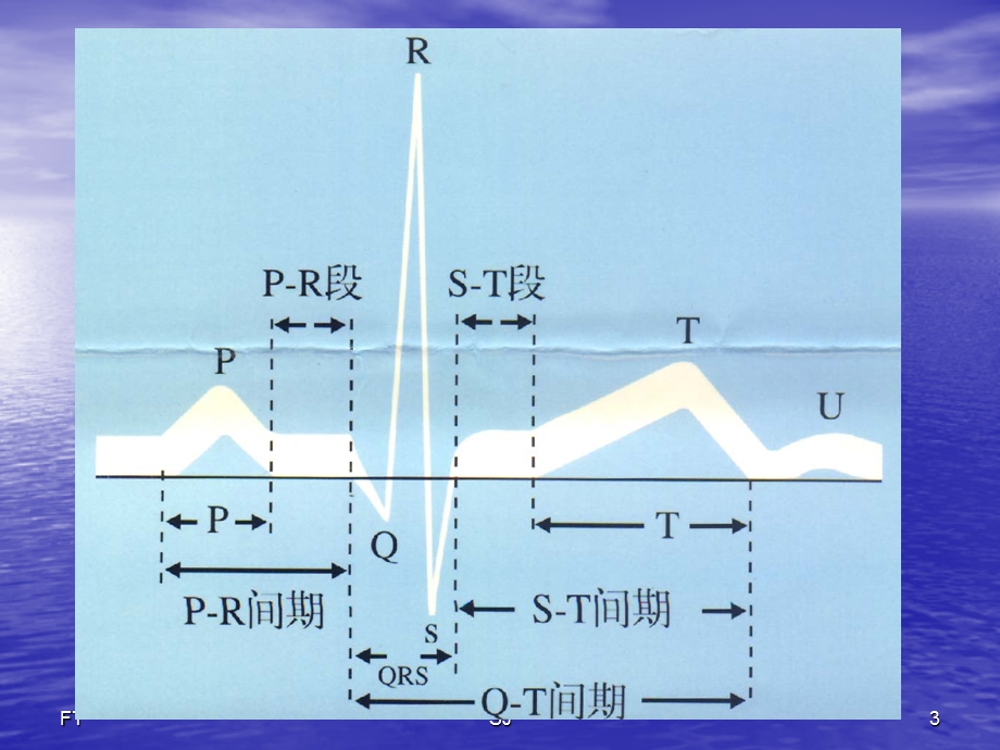 心电图正常值及异常的临床意义.ppt_第3页