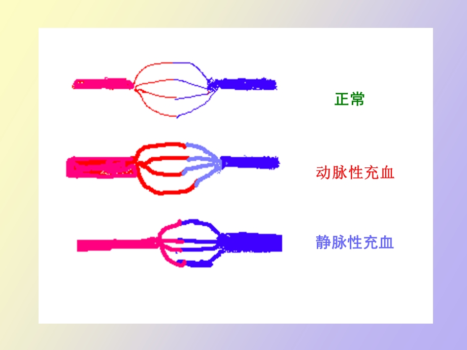 现代基础医学概论第十四章.ppt_第3页