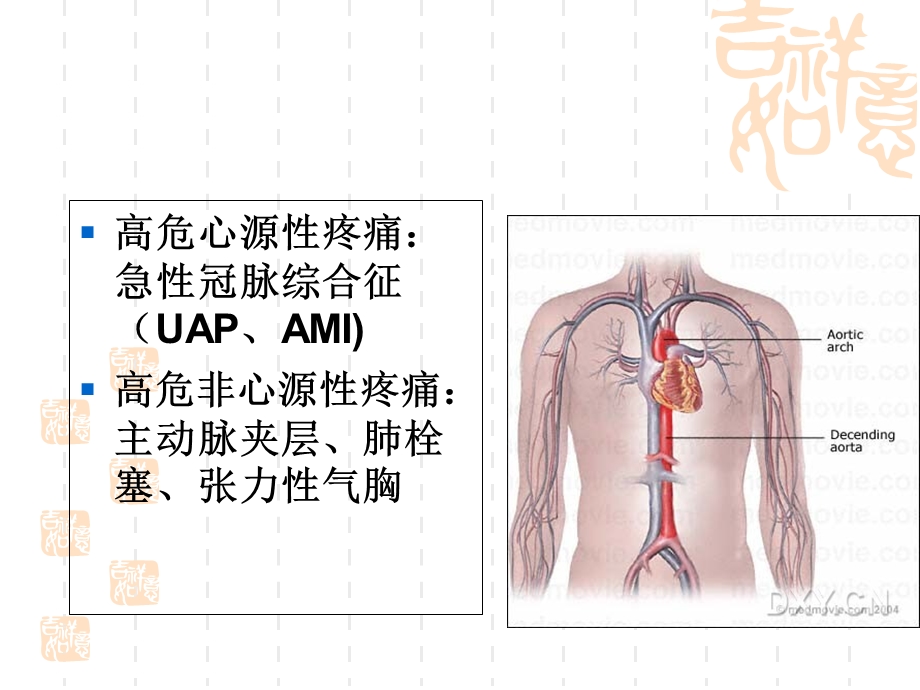 胸痛的鉴别诊断和诊断流程.ppt_第3页