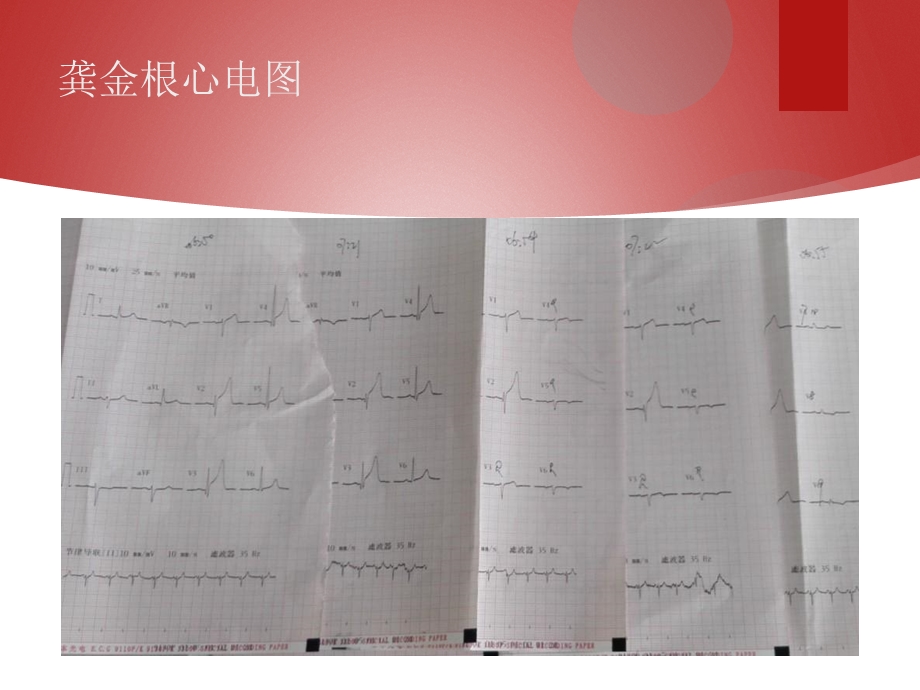 胸痛中心质量分析.ppt_第3页