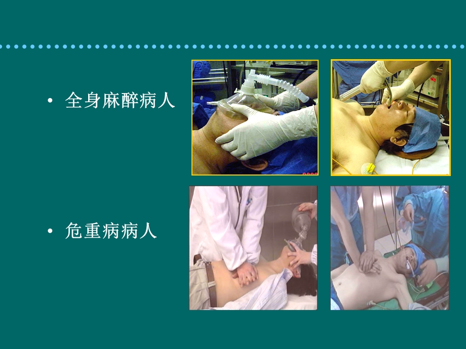 麻醉教学气道管理.ppt_第3页