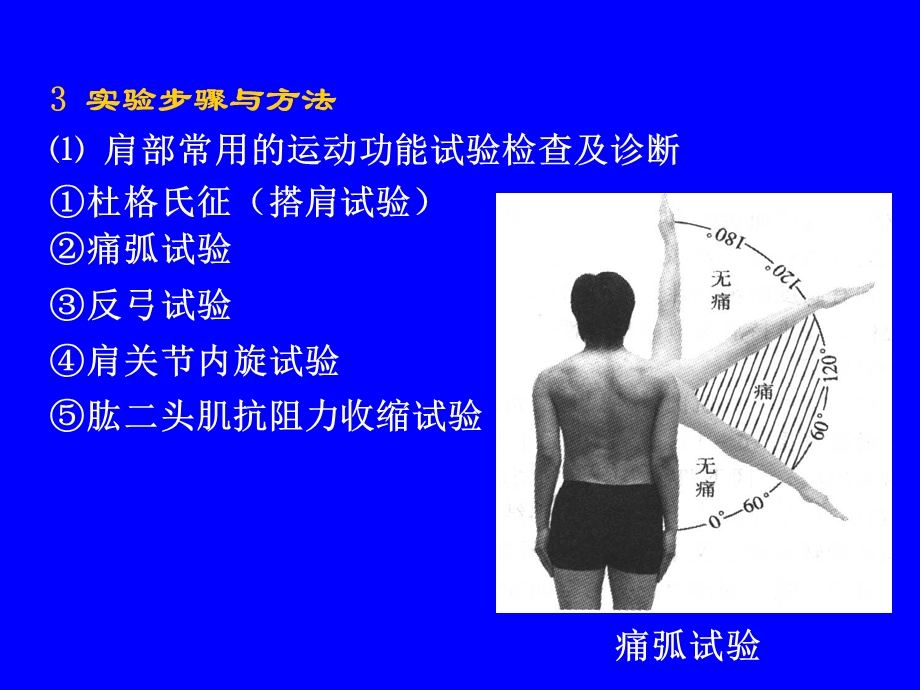 各部位运动损伤的试验检查.ppt_第2页