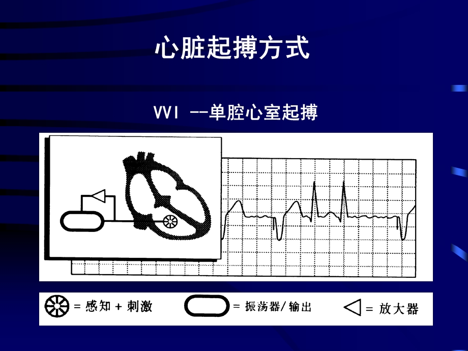 心脏起搏器适应证与应用.ppt_第3页